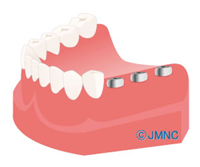 井原市・さくら歯科クリニック