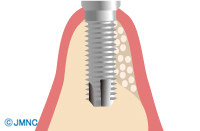井原市・さくら歯科クリニック