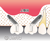 井原市・さくら歯科クリニック